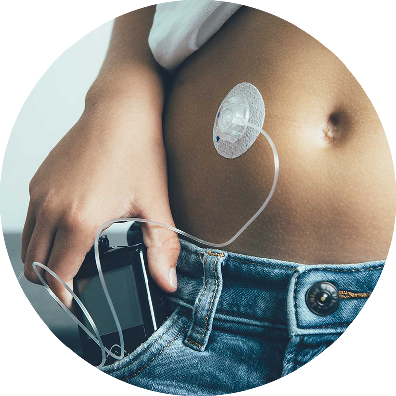 tethered pump being worn by person