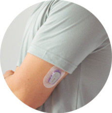 A CGM on someones arm