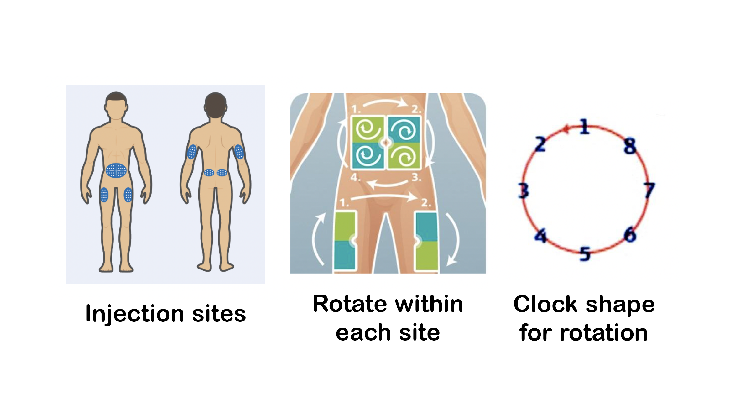 injection sites, rotate within each site, clock or circular pattern for rotation.