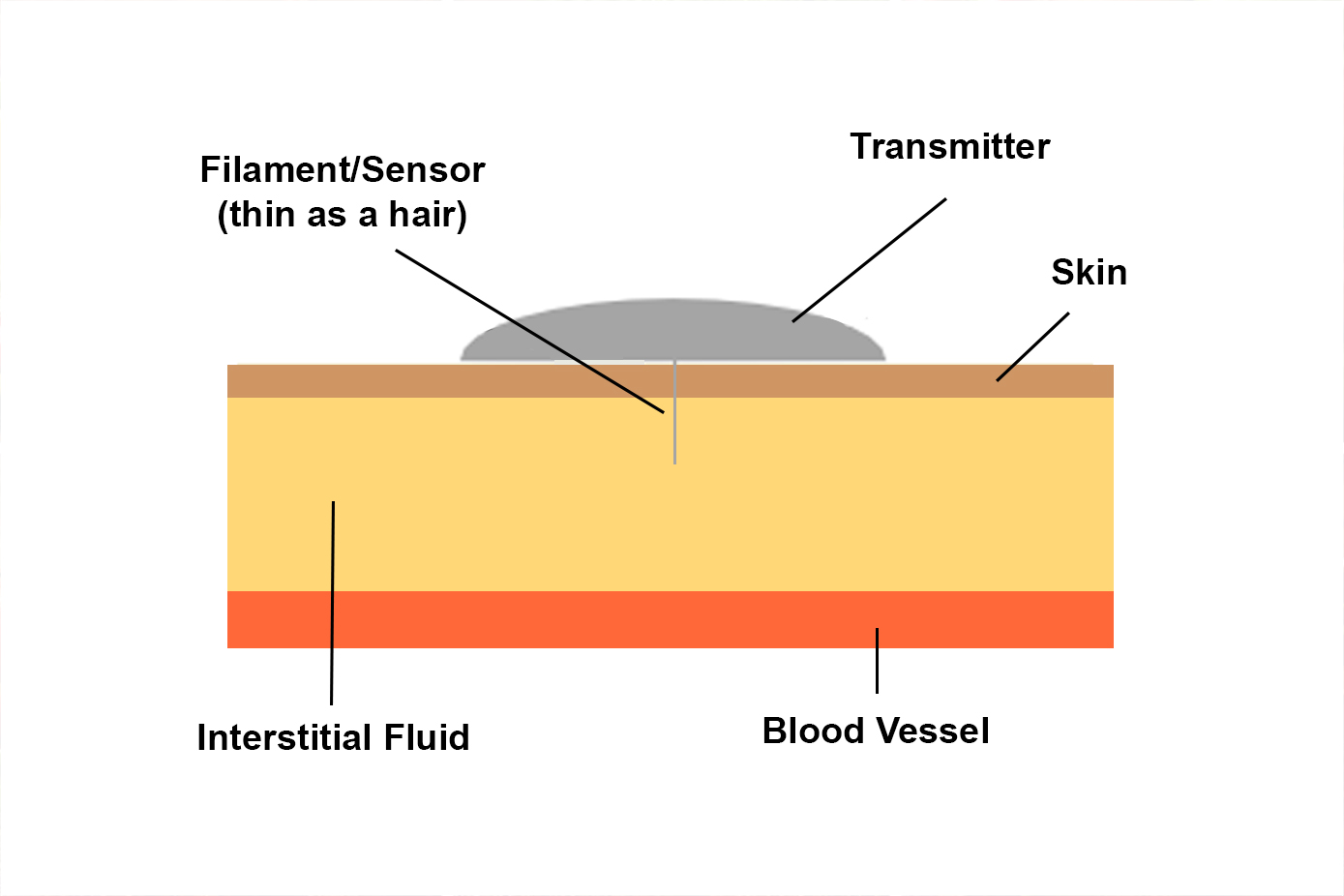 Graphic shows filament/sensor (thin as a hair) transmitter (on top of filament), skin, interstitial fluid and blood vessel. Filament goes into interstitial fluid.